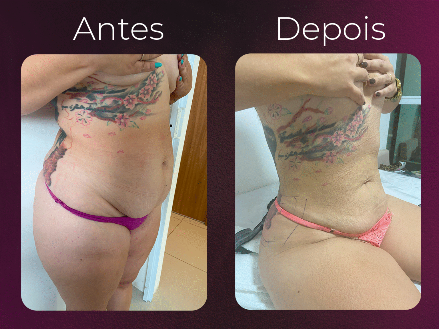 antes e depois harmony 01