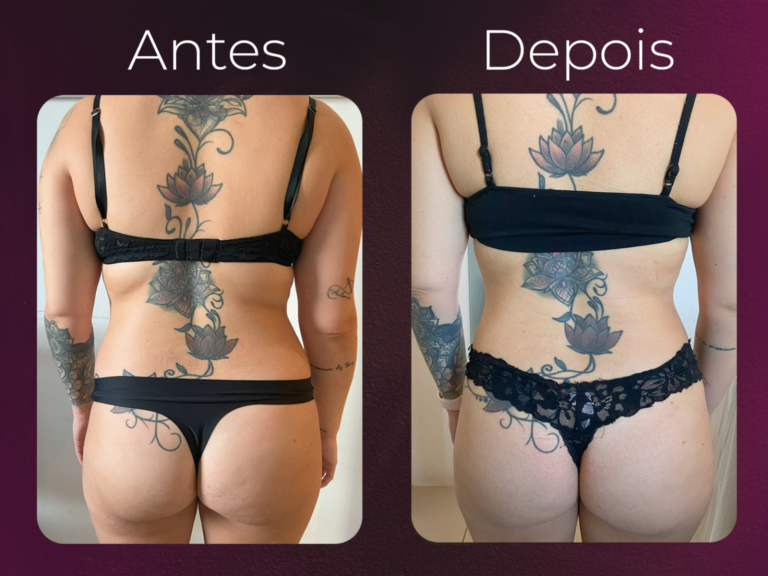 antes e depois harmony 02