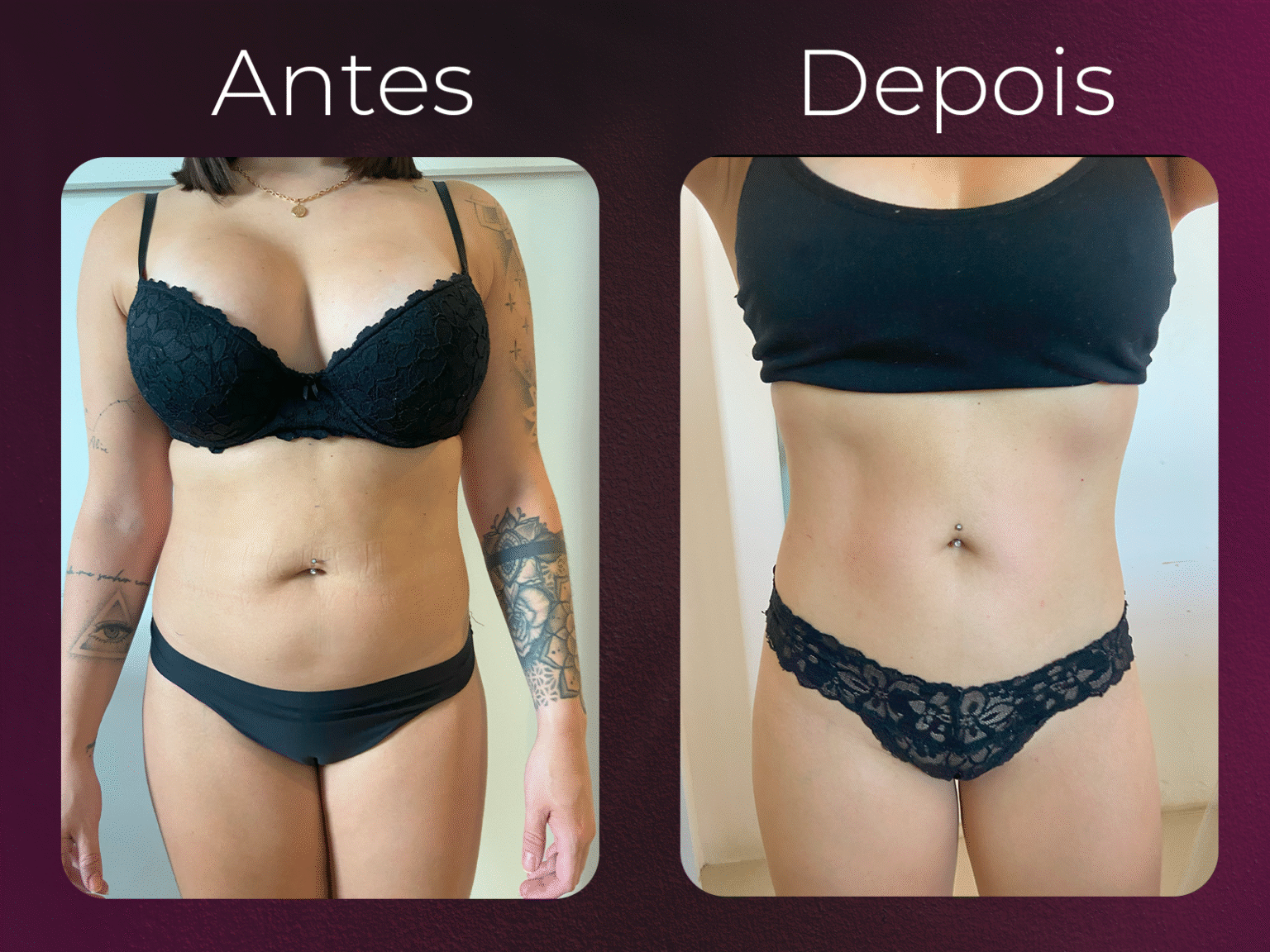 antes e depois harmony 03