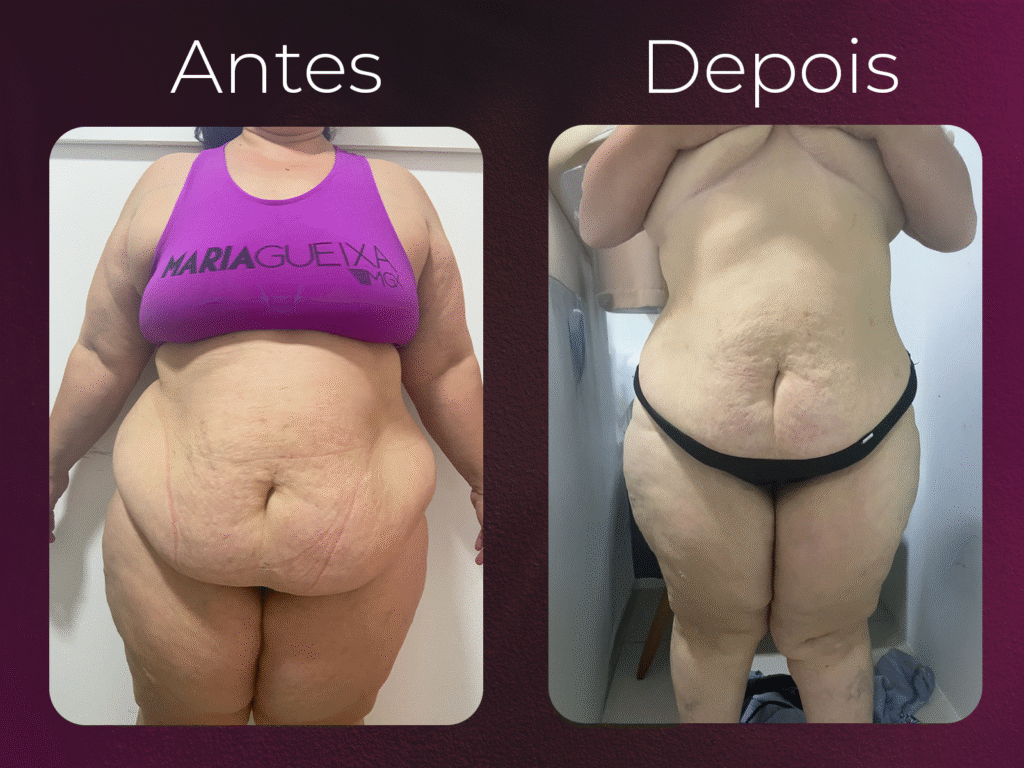 antes e depois harmony